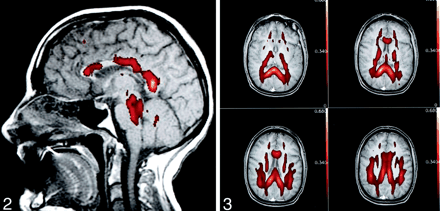 Fig 2.