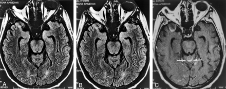 Fig 3.