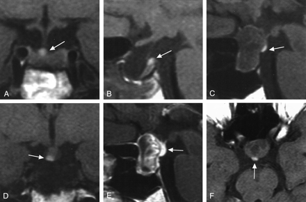 Fig 2.