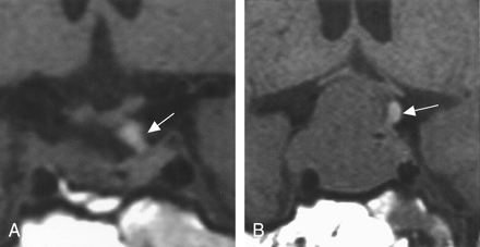 Fig 3.