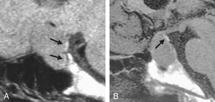 Fig 4.