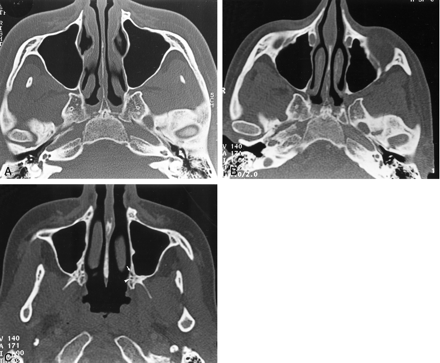 Fig 2.