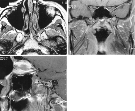 Fig 4.