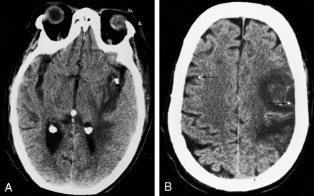 Fig 3.
