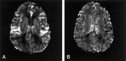 Fig 2.