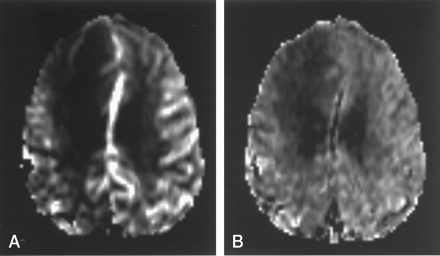 Fig 3.
