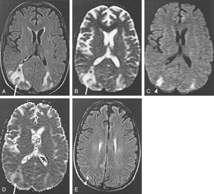 Fig 6.