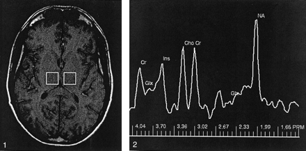 Fig 1.