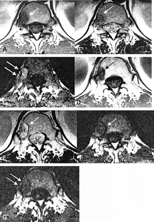 Fig 2.