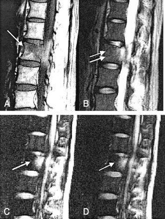 Fig 3.