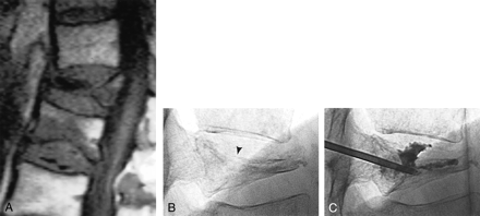 Fig 1.