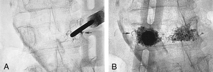 Fig 4.