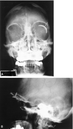 Fig 1.