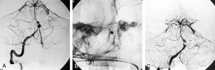 Fig 2.
