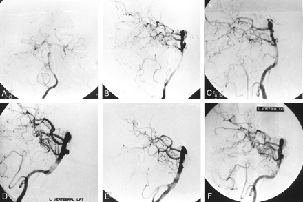Fig 3.