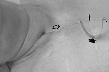 Fig 2.