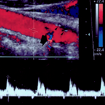 Fig 3.