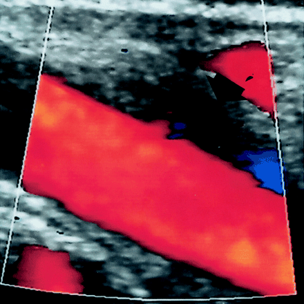 Fig 4.