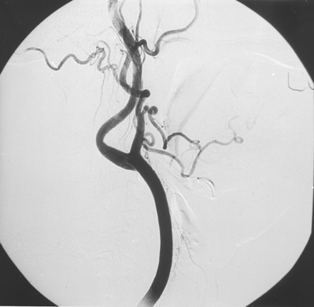 Fig 5.