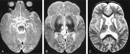 Fig 2.
