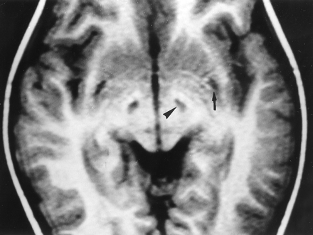 Fig 3.