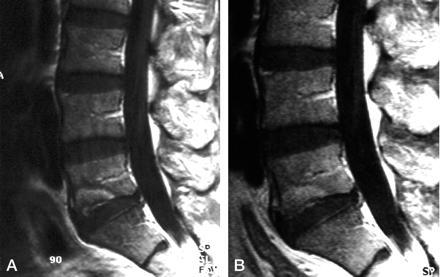 Fig 1.