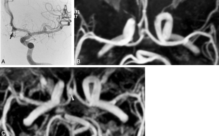 Fig 3.