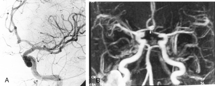 Fig 4.