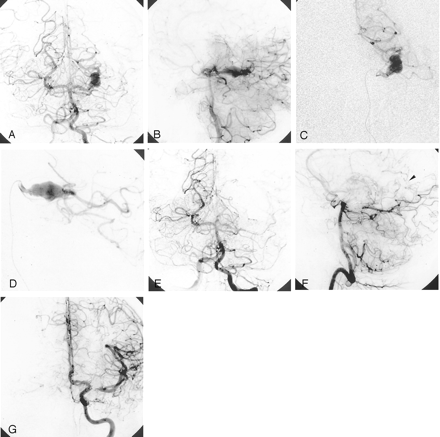 Fig 1.