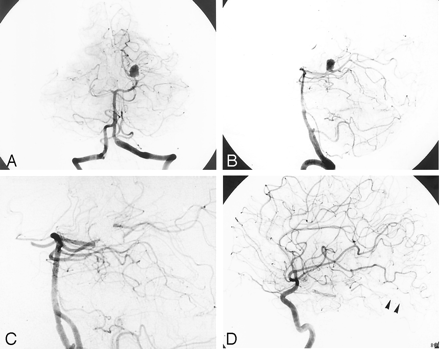 Fig 2.