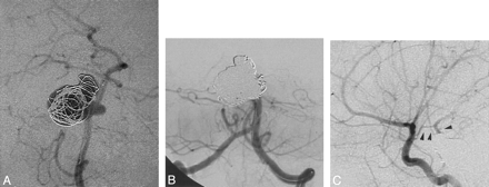 Fig 3.