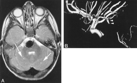 Fig 4.