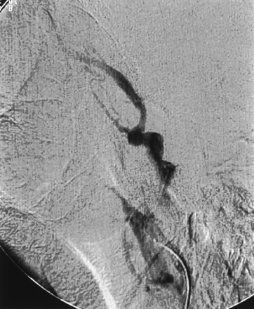 Fig 3.