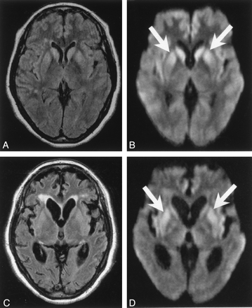 Fig 1.