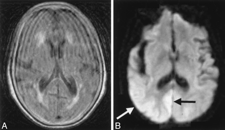 Fig 4.