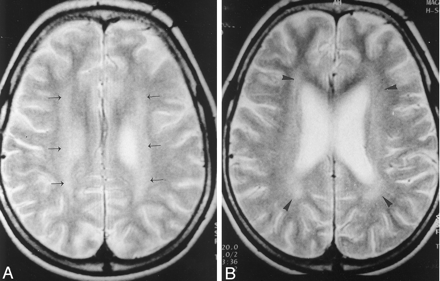 Fig 1.
