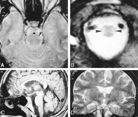 Fig 2.