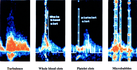 Fig 6.