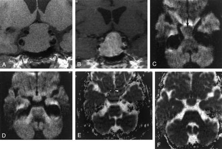 Fig 3.
