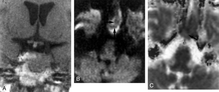 Fig 4.