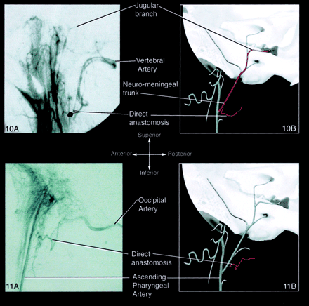 Fig 11.