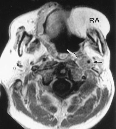 Fig 1.