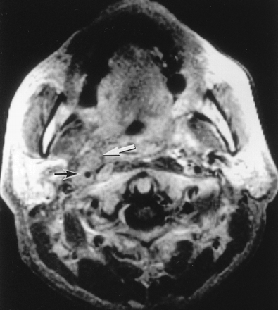 Fig 2.