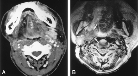 Fig 3.