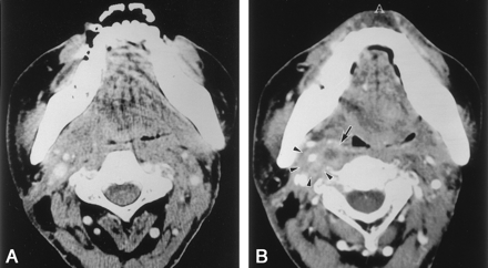 Fig 4.