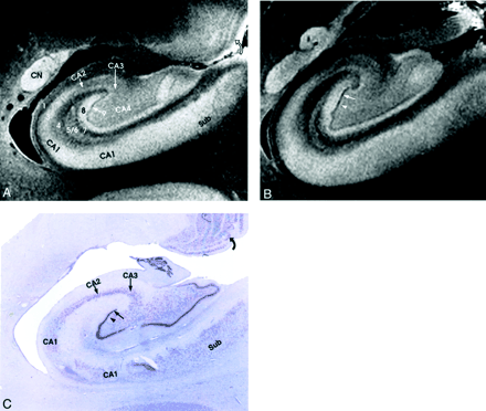 Fig 3.
