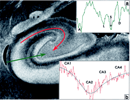 Fig 4.