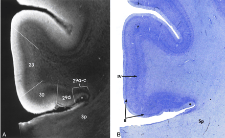 Fig 5.