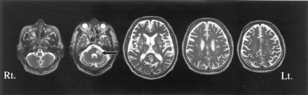 Fig 1.