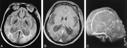 Fig 2.
